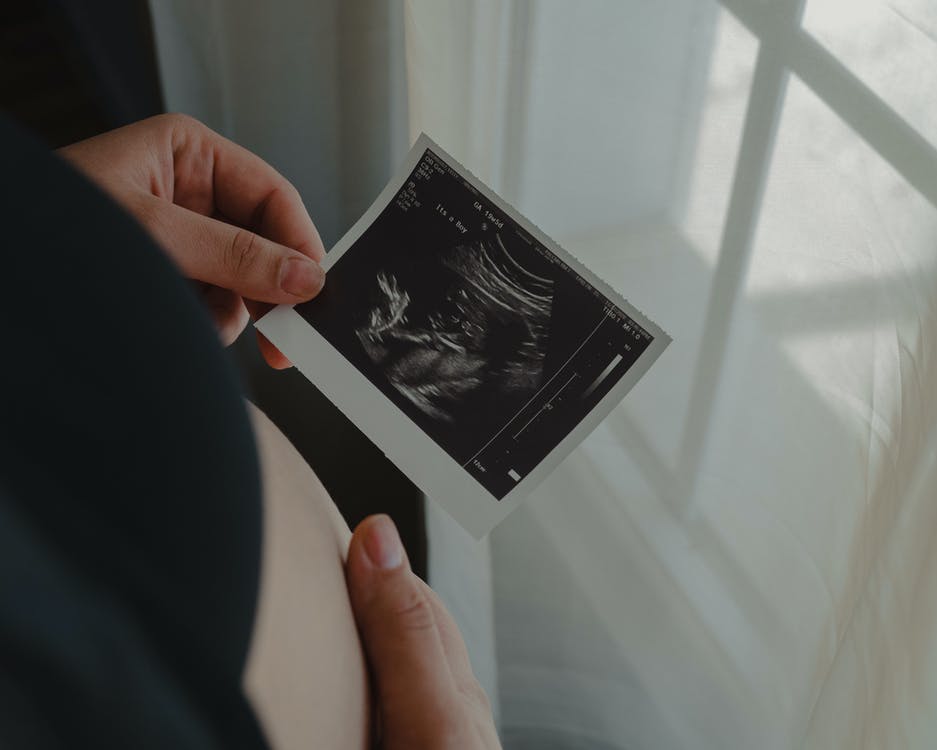 [LiveAction.org] Povedie zvrat rozhodnutia Roe vs. Wade k väčšiemu počtu úmrtí súvisiacich s tehotenstvom? Štatistiky hovoria, že nie.